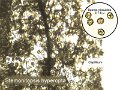 Stemonitopsis hyperopta-amf4-micro